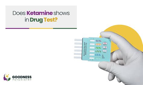 ketamine show up on drug test: How Ketamine Use Affects Drug Test Results and What to Know